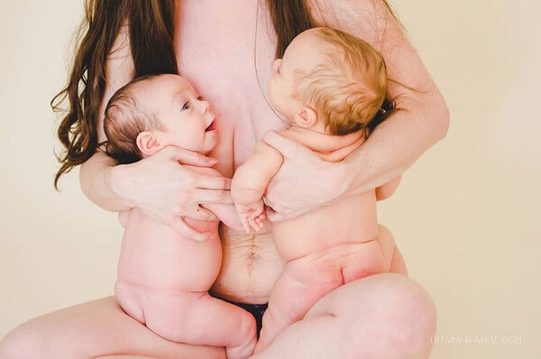 21 bức ảnh về cơ thể của người mẹ sau sinh khiến người xem xúc động 24