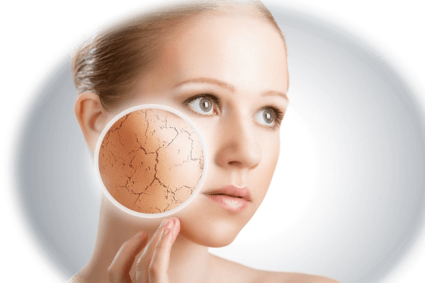6 lý do tại sao dưỡng ẩm da tốt cho sức khỏe 6