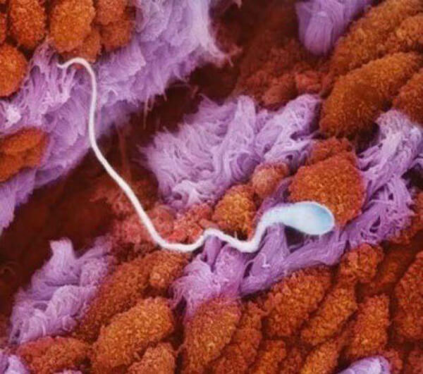 Tinh trùng di chuyển trong ống dẫn trứng