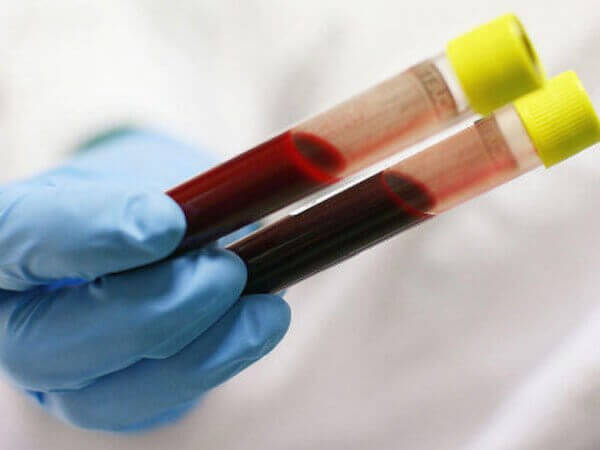 can-trong-thalassemia-can-benh-di-truyen-sang-tre