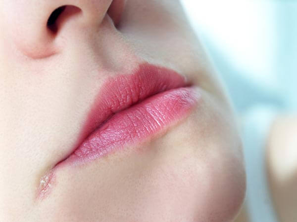 Đôi môi và những dấu hiệu cảnh báo sức khỏe 9
