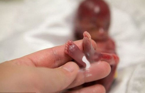 Nếu bạn có ý định phá thai, hãy đọc bài viết này trước đã 16