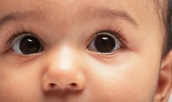 Những bệnh mắt ở trẻ mẹ nên biết! 8