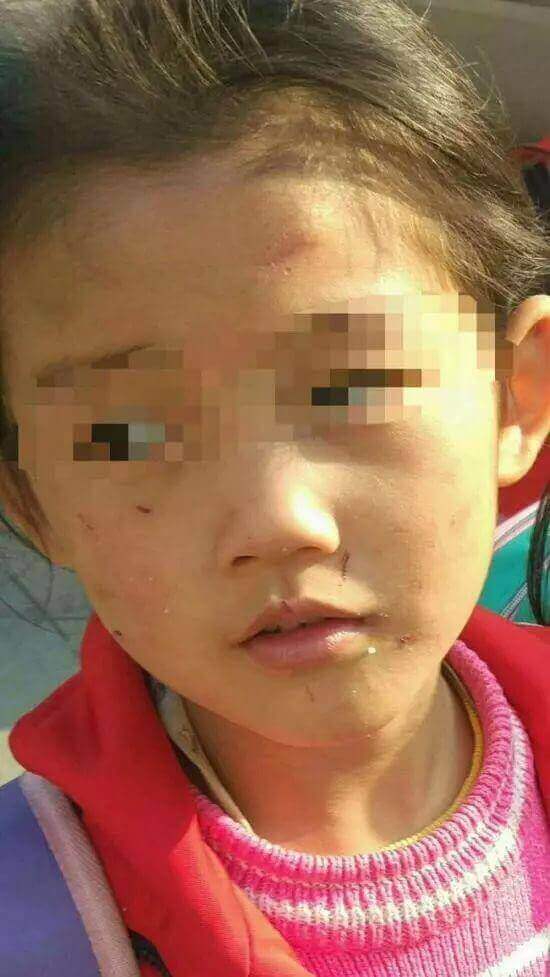 Bạo hành trẻ em: Mẹ đánh đập con đến tróc hết cả tóc 7