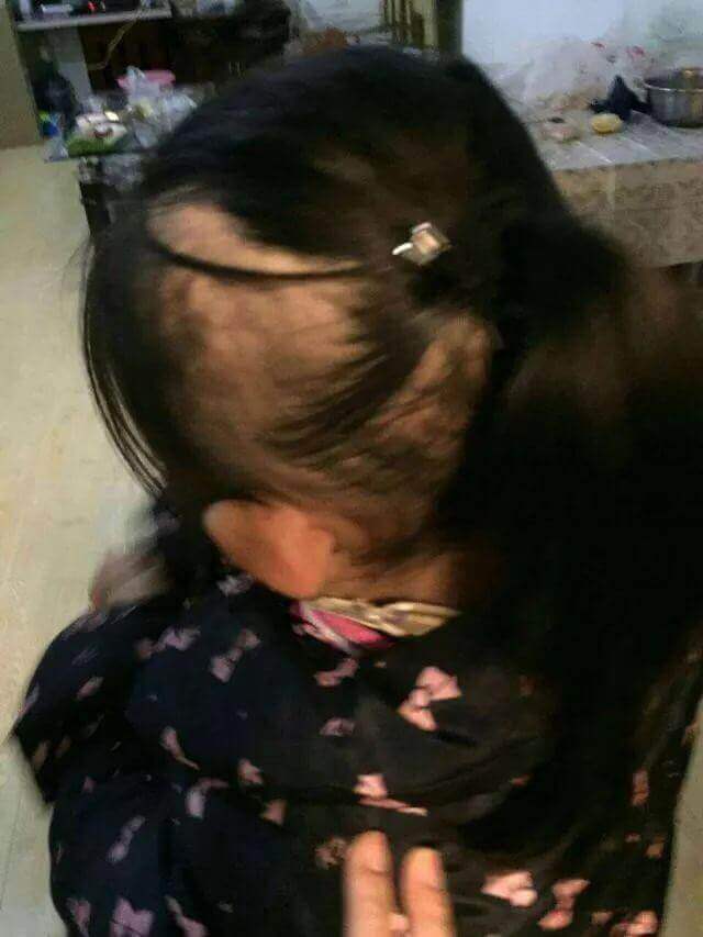 Bạo hành trẻ em: Mẹ đánh đập con đến tróc hết cả tóc 8