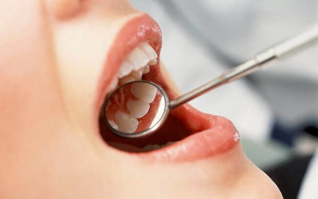 Giải đáp thắc mắc: Nhổ răng khôn có đau không? 3