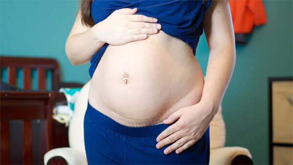 Nhận biết những dấu hiệu nhiễm trùng vết mổ sau sinh 5