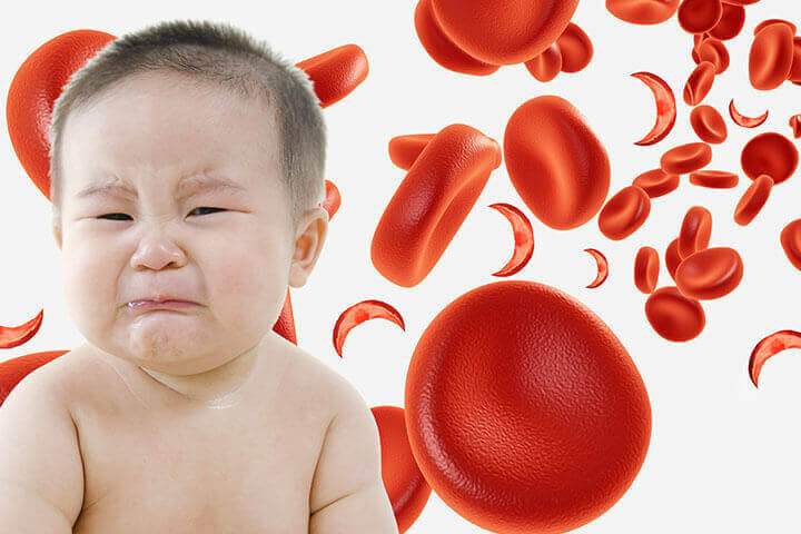 trẻ bị thiếu máu có nguy hiểm không 