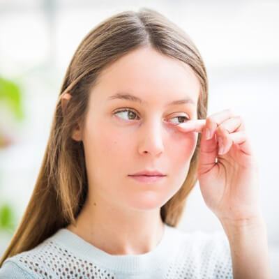 Mặt nạ trà xanh “giải cứu” đôi mắt sưng húp và quầng thâm hiệu quả 8
