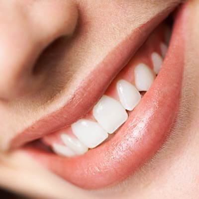 Điểm danh những yếu tố hàng đầu làm hỏng răng 8