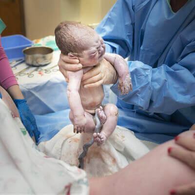 Những hình ảnh tuyệt đẹp về dây rốn của trẻ sơ sinh 10
