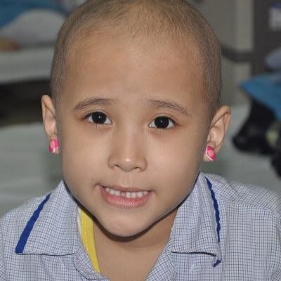 Ung thư ở trẻ em: Những dấu hiệu nhận biết quan trọng 2