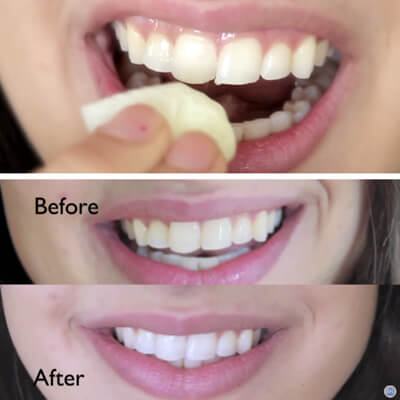 Video: Tẩy răng trắng sáng chỉ trong 2 phút bằng chanh tươi 2