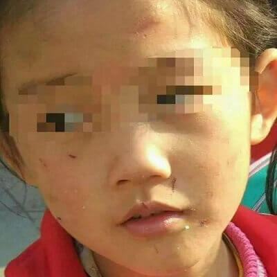 Bạo hành trẻ em: Mẹ đánh đập con đến tróc hết cả tóc 9
