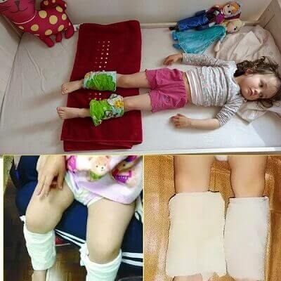 Quấn khăn ở chân là cách hạ sốt cho trẻ phổ biến của mẹ Tây 4