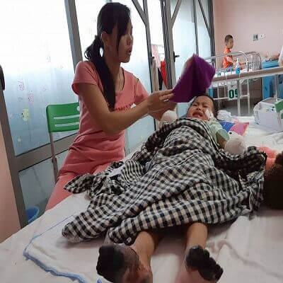 Bé gái 3 tuổi hoại tử chân tay sau một đêm bị sốt 2