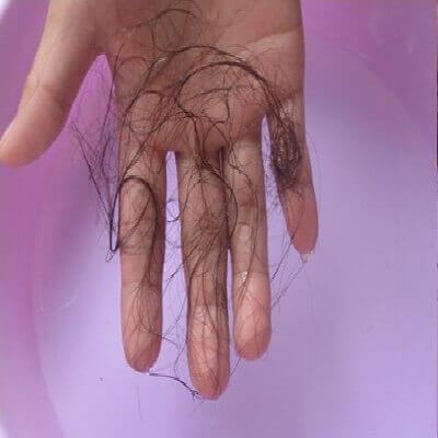 ‘Điểm mặt’ những nguyên nhân gây rụng tóc ở nữ giới 4