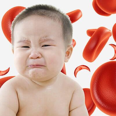 Trẻ bị thiếu máu có nguy hiểm không, chữa như thế nào? 1