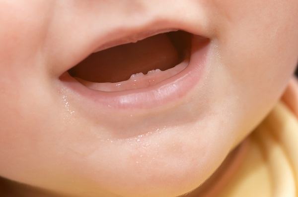 Lịch mọc răng ở trẻ nhỏ mẹ đã biết hay chưa? 3