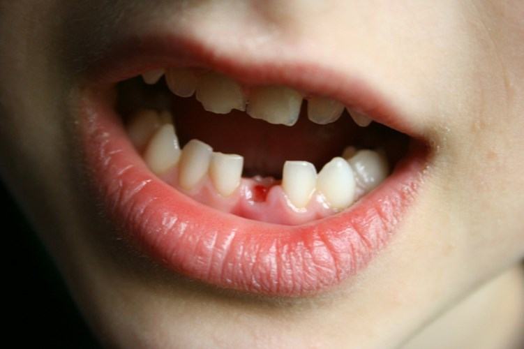 20 bí mật thú vị về những chiếc răng sữa 6