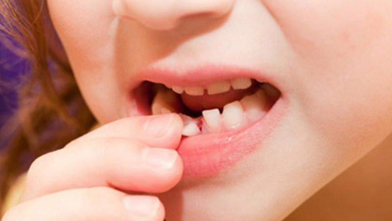 20 bí mật thú vị về những chiếc răng sữa 9