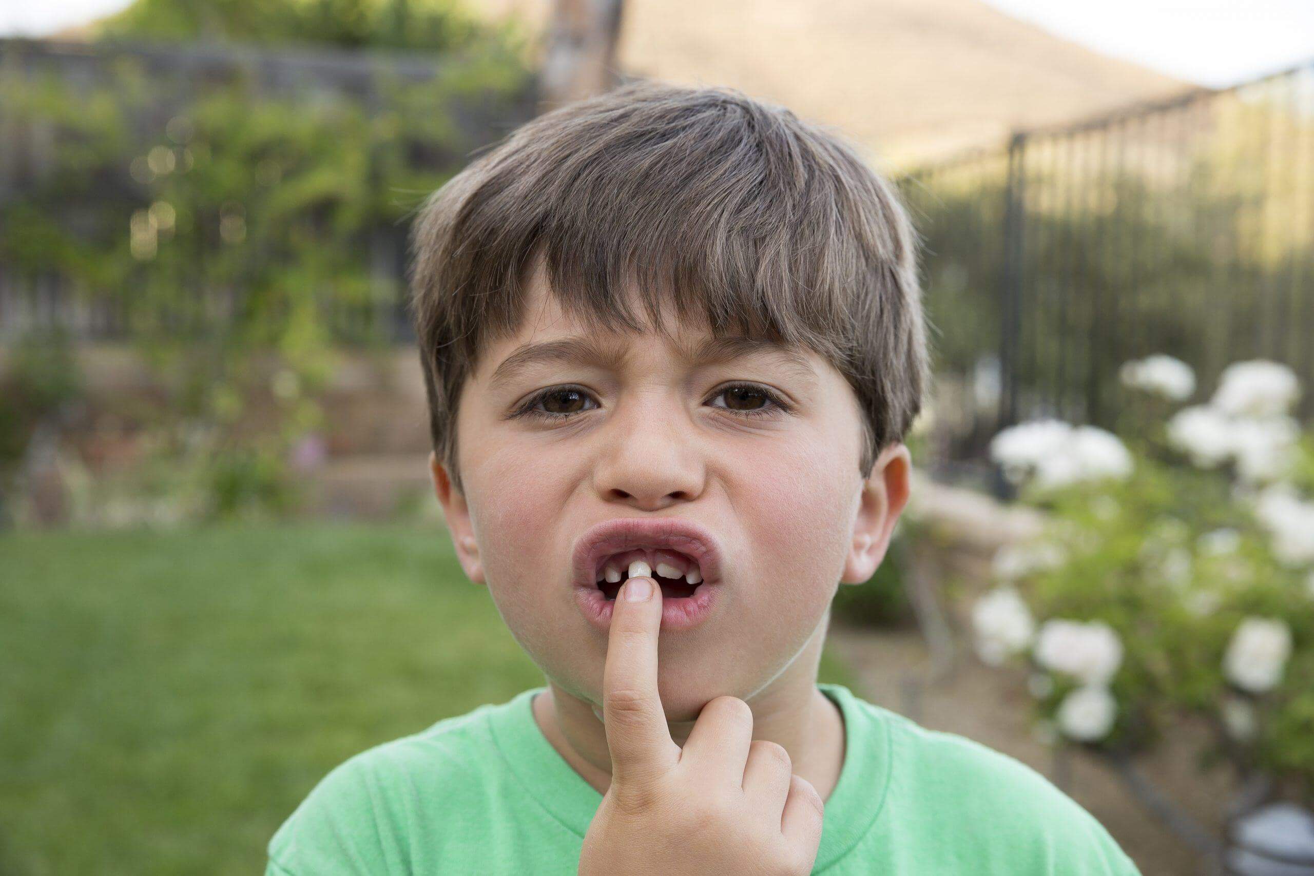 Bật mí bạn 3 căn bệnh răng miệng thường gặp nhất ở trẻ nhỏ! 1