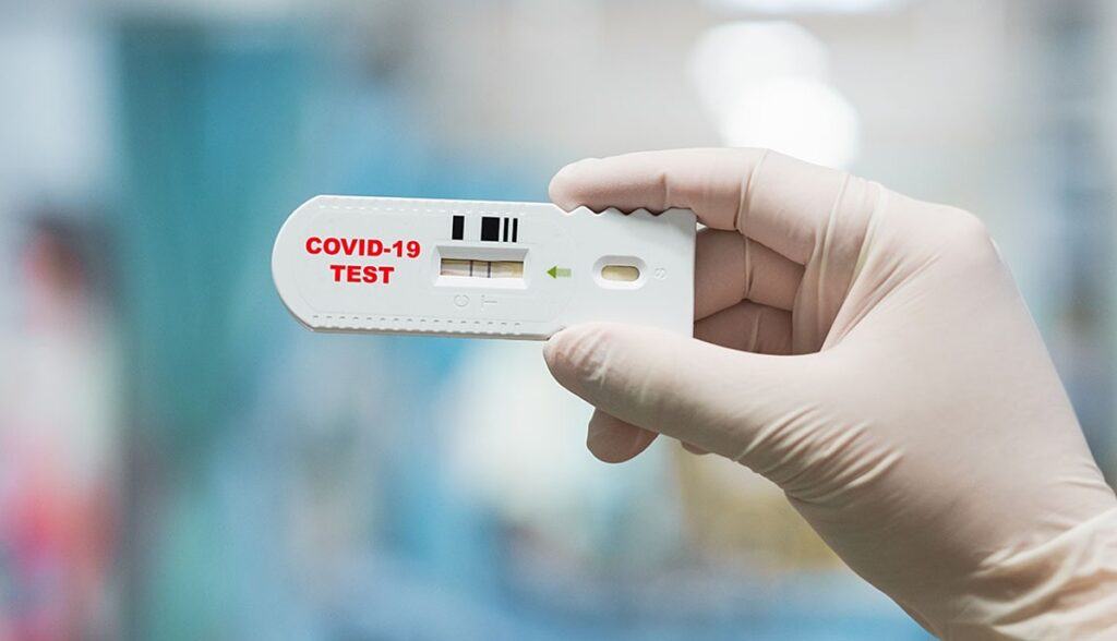 test nhanh COVID-19