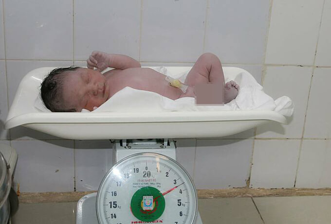 Hải Phòng: Cặp đôi lớn tuổi có con sau 30 năm vô sinh 35 Hải Phòng: Cặp đôi lớn tuổi có con sau 30 năm vô sinh 16