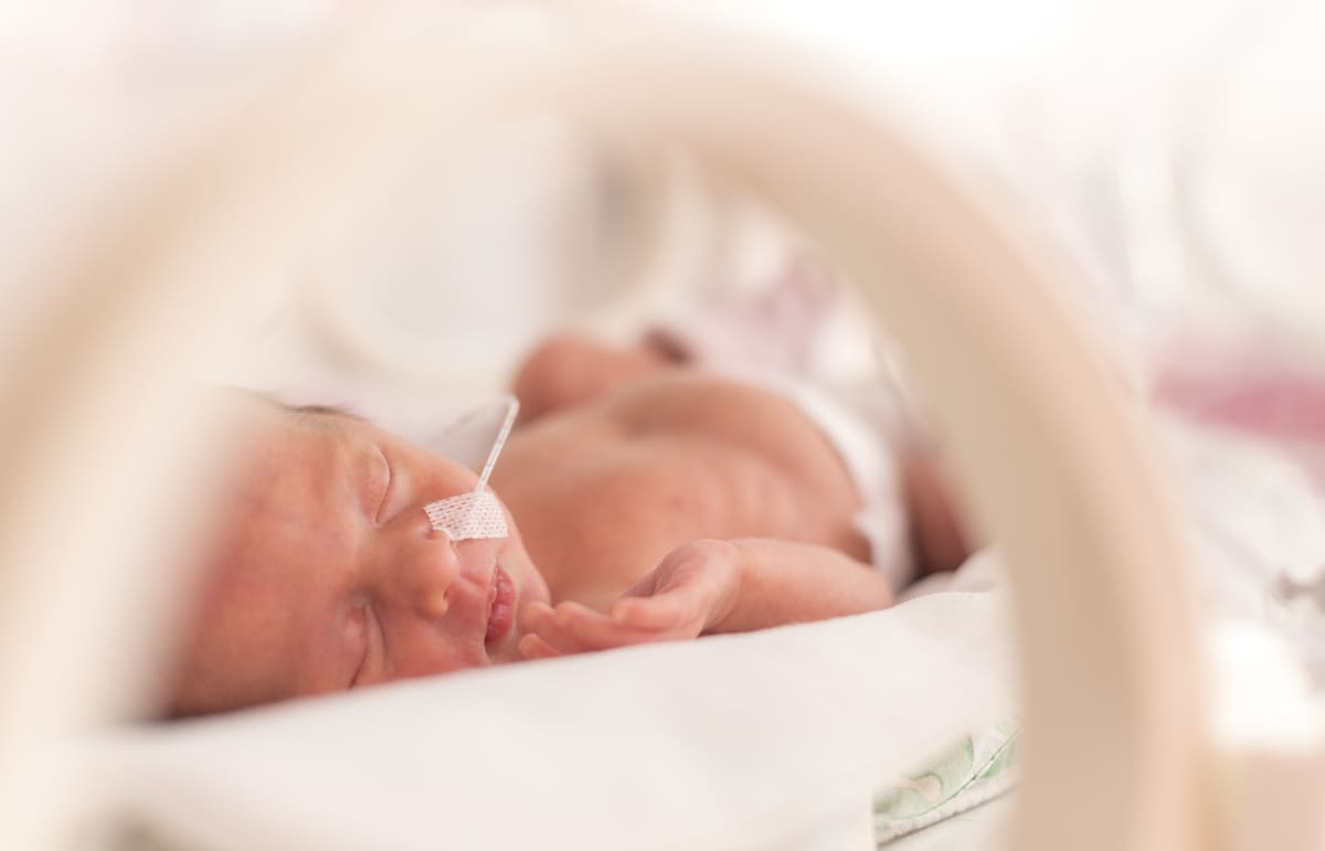 Hội chứng đột tử ở trẻ sơ sinh non tháng