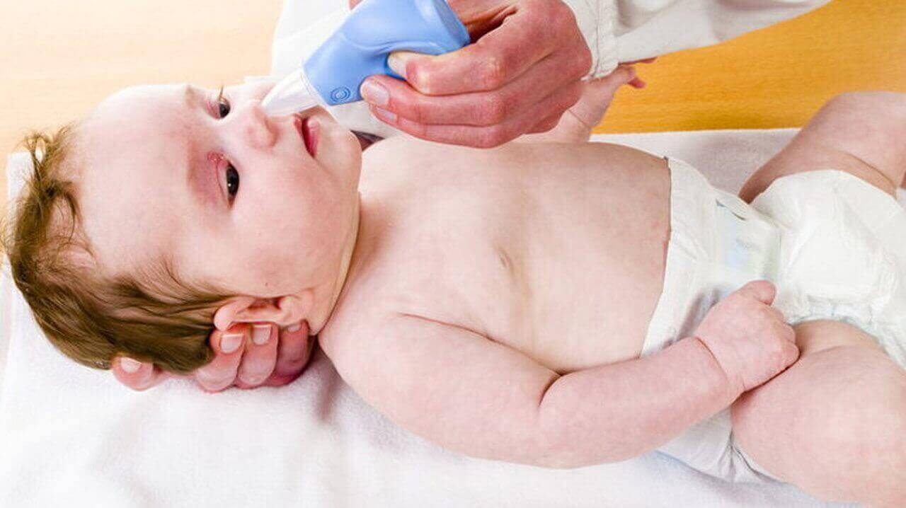 chữa sổ mũi ở trẻ sơ sinh