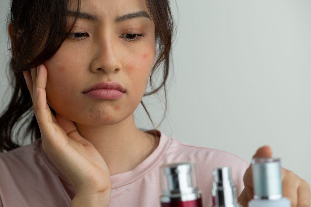 trị sẹo thủy đậu