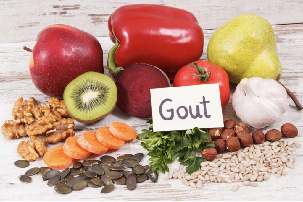 Người bệnh gout nên ăn gì và kiêng gì để kiểm soát bệnh?