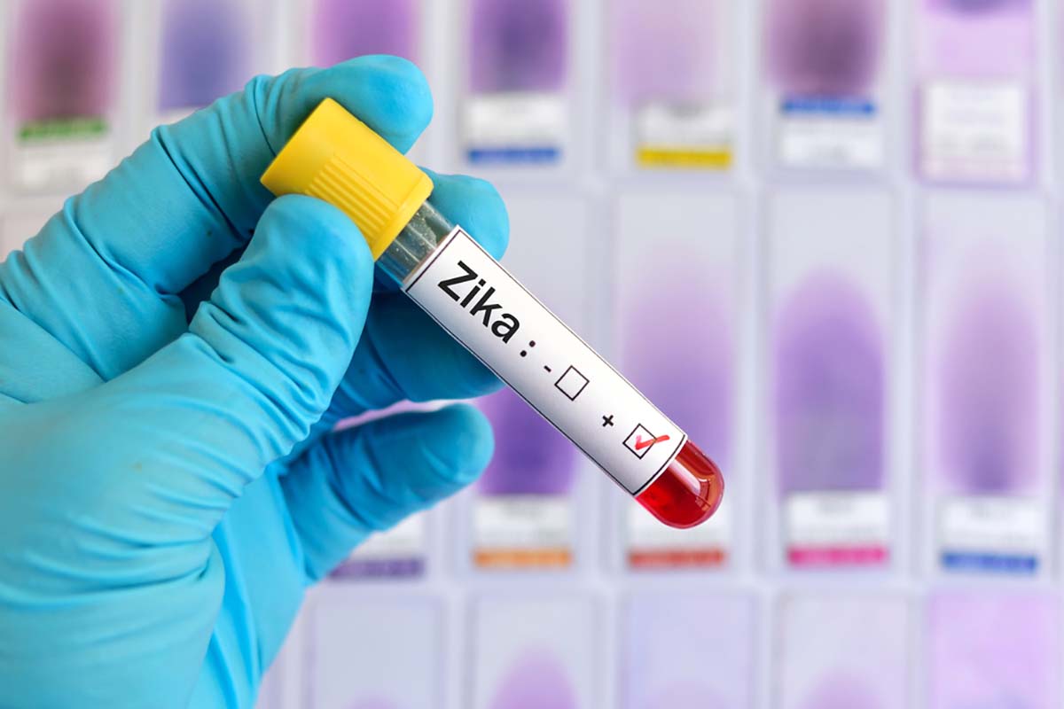 các xét nghiệm khi mang thai rất quan trọng gồm xét nghiệm sàng lọc virus zika