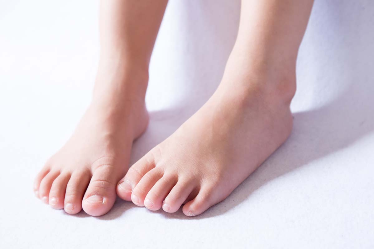 Hội chứng bàn chân bẹt ở trẻ em nguy hiểm