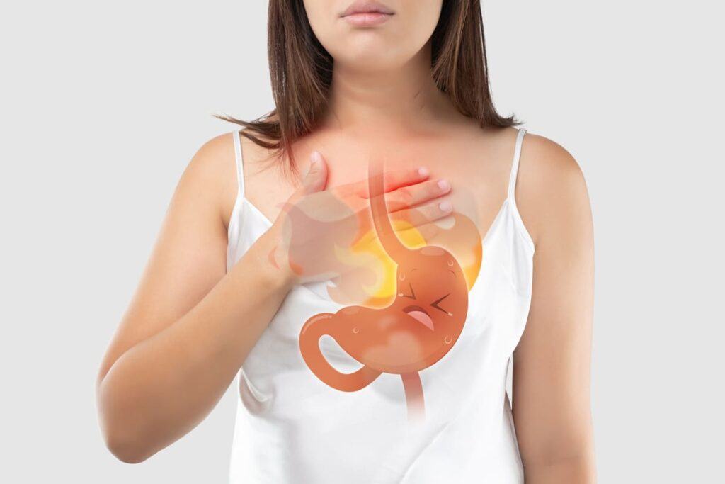 trào ngược dạ dày thực quản