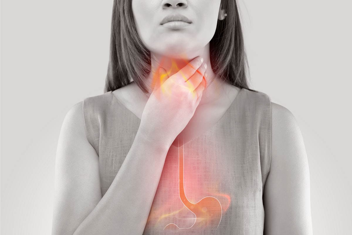 Trào ngược axit dạ dày là nguyên nhân gây nóng rát cổ họng