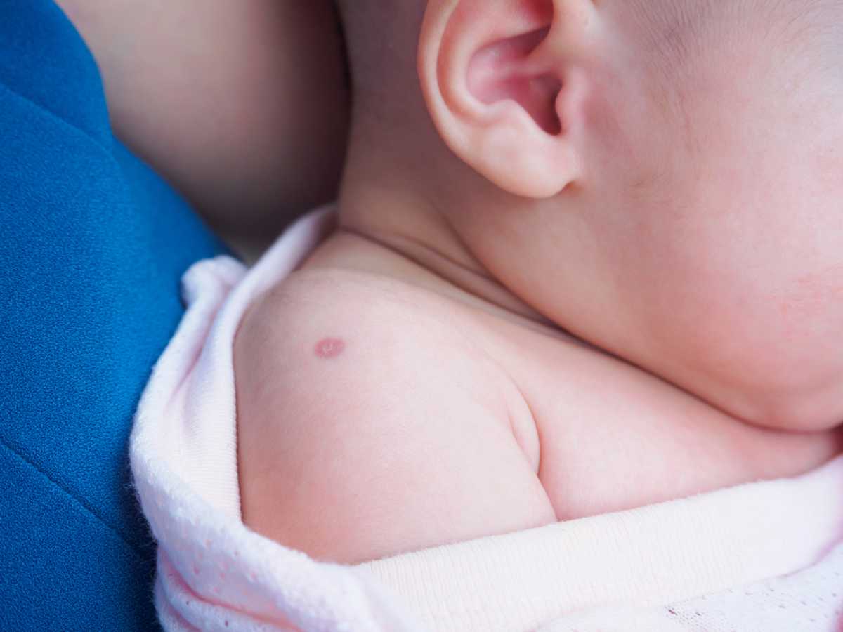 Những điều cần biết về tiêm lao cho trẻ sơ sinh