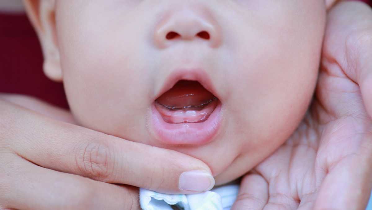 Thời điểm trẻ sơ sinh mọc răng