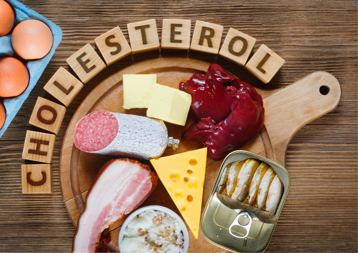 Cholesterol cao nên ăn gì và kiêng gì