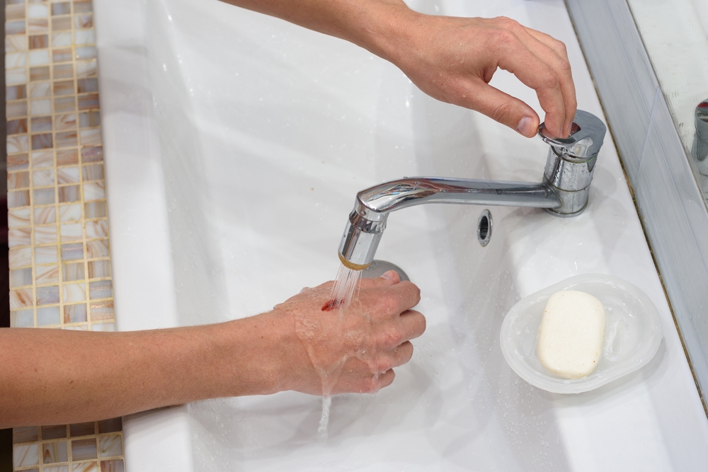 cách làm vết thương hở mau khô​ đúng cách