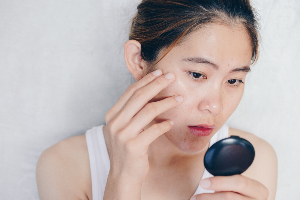dưỡng ẩm cho da dầu mụn và vì sao da dầu mụn cần dưỡng ẩm