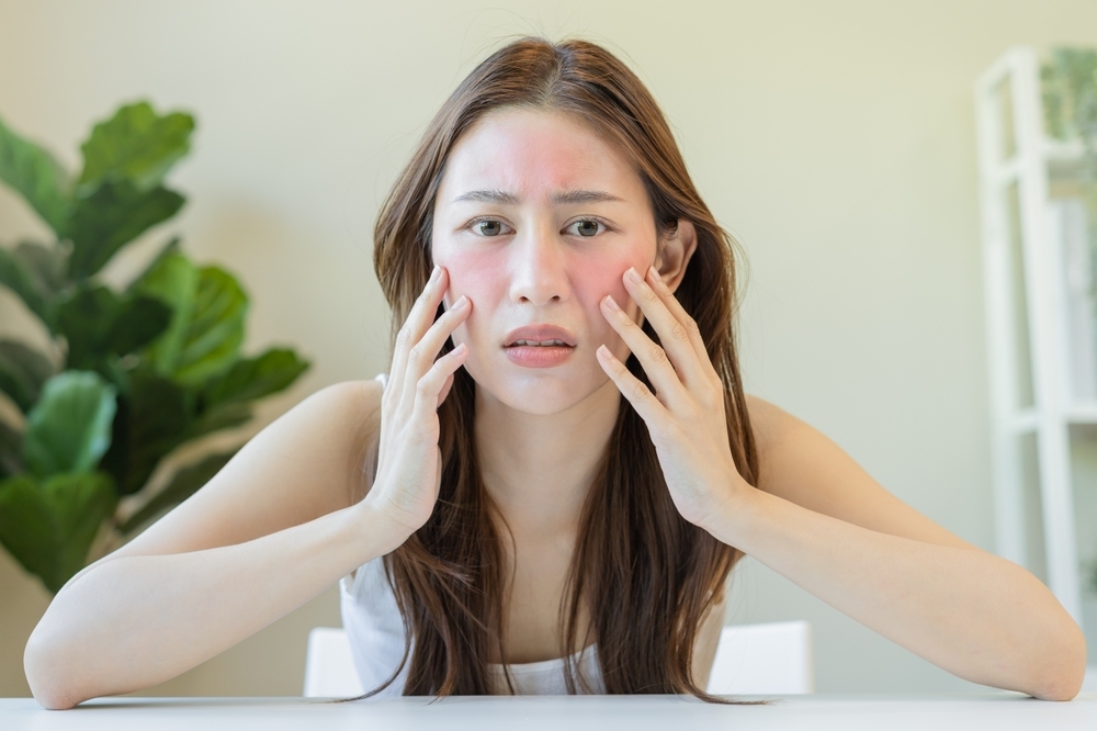cách trị dị ứng mỹ phẩm tại nhà nhanh nhất​