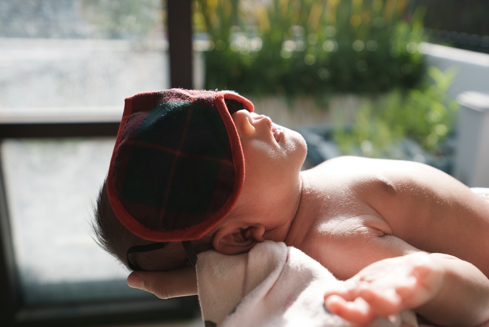 trẻ sơ sinh bị vàng da nên bổ sung gì​ và tắm nắng 
