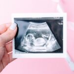 cân nặng theo tuổi thai​