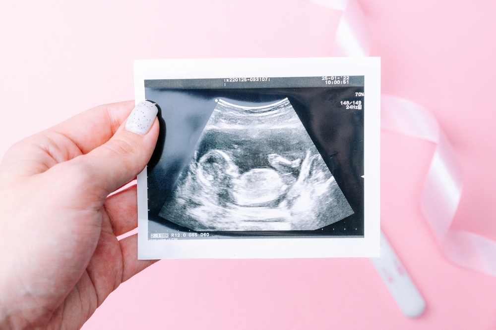 cân nặng theo tuổi thai​