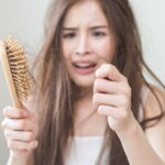 tóc rụng nhiều