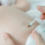 trẻ sơ sinh rụng rốn nhưng chưa khô​