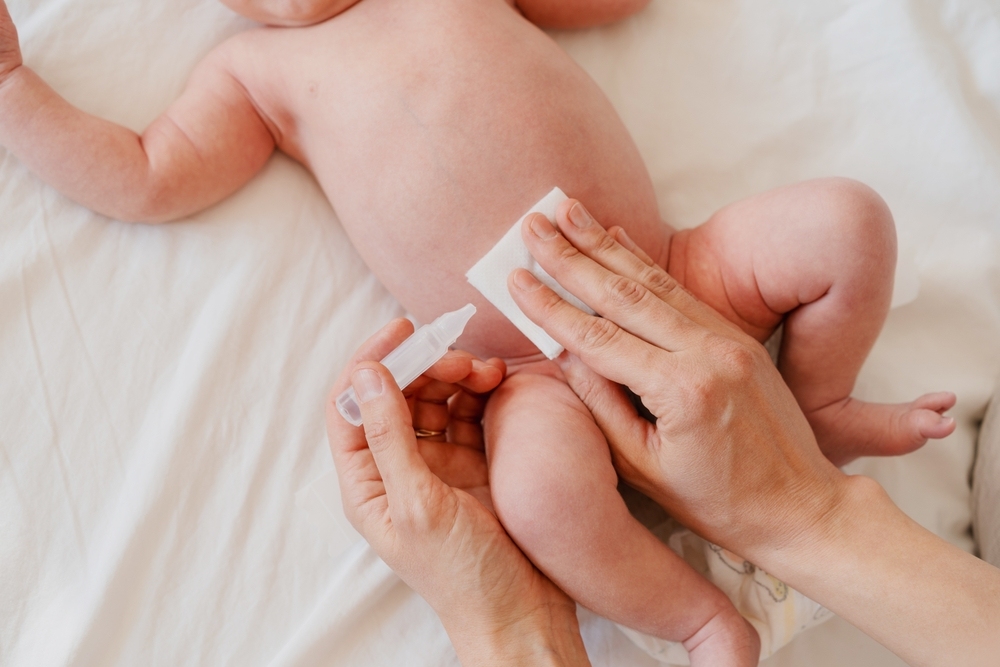 Cách chăm sóc trẻ sơ sinh rụng rốn nhưng chưa khô đúng cách