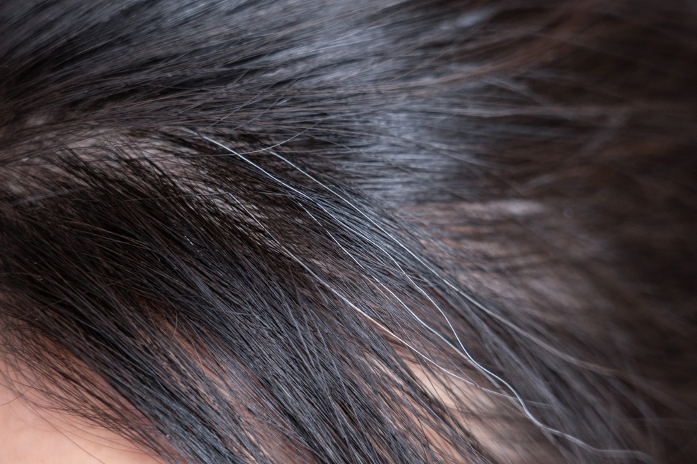 Thực trạng tóc bạc sớm ở người trẻ ngày nay Thực trạng tóc bạc sớm ở người trẻ hiện nay