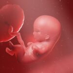 độ mờ da gáy bao nhiêu là an toàn​